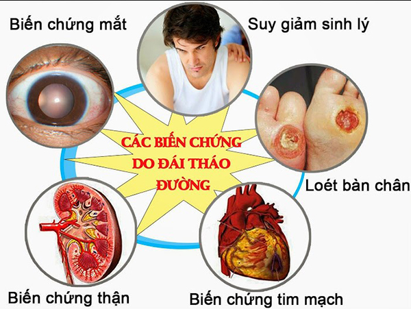 toi den va benh tieu duong